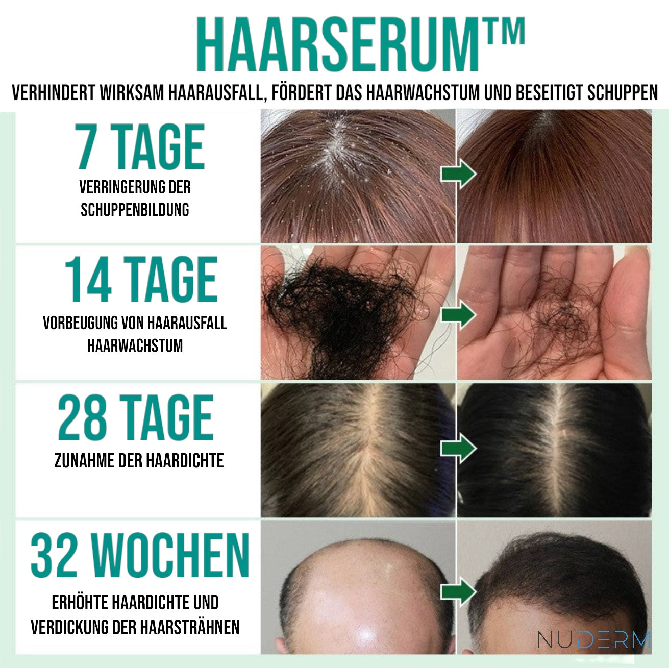 HAARSERUM™ mit Rosmarin