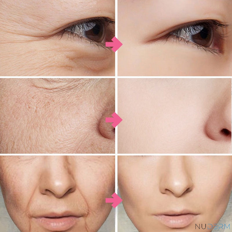 SKINSERUM™ mit Vitamin C